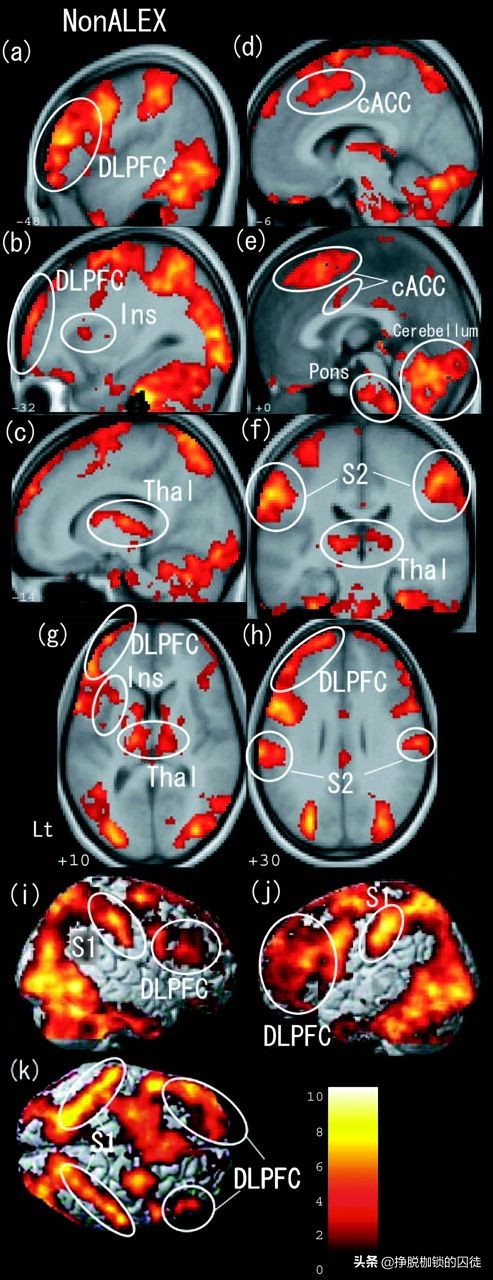 看到别人伤口疼自己也会感觉痛,看见别人疼自己也会疼是怎么回事