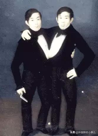 罕见双头连体人能活多久,诡异的双头生物