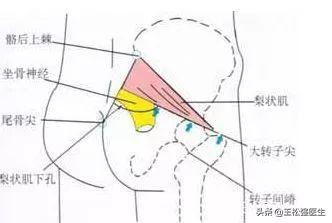 腰4-5椎间盘突出最好的治疗方法,不是所有的腰痛都是腰间盘突出