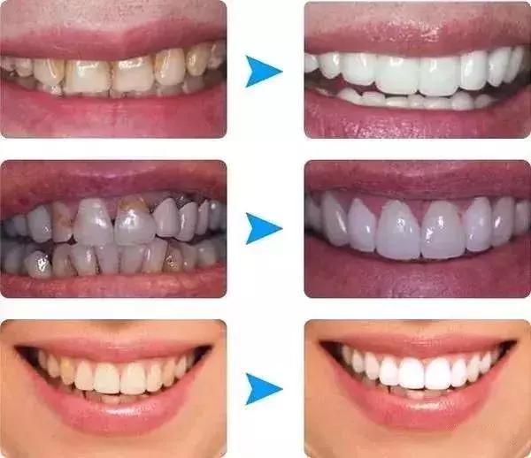 倪妮泳装露齿笑又迷倒一票人！湿法风格突然走火，牙白才敢这样玩