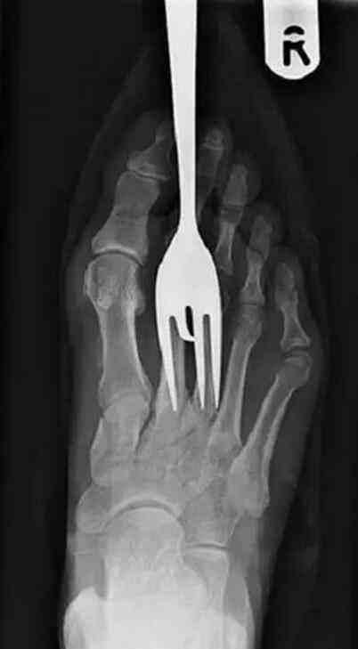 不作死就不会死看看你中了几条,不作死就不会死让人看的头皮发麻