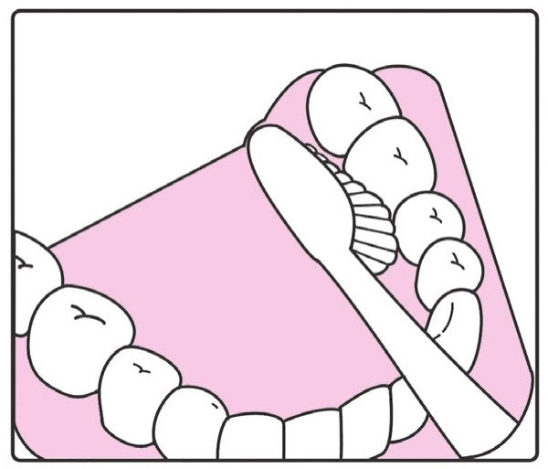 儿童换牙用什么牙膏刷牙,5岁换牙该注意事项