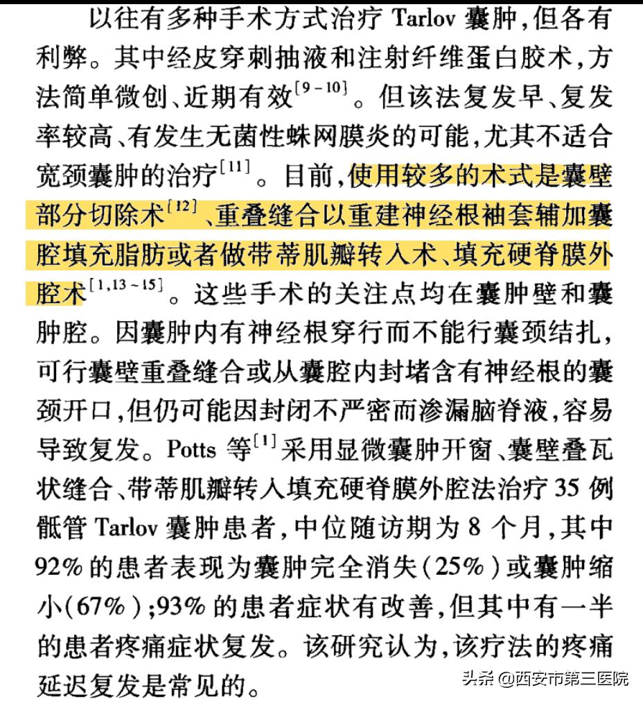 【医者解读】揭开“骶管囊肿”之神秘面纱，查出骶管囊肿都需要治疗吗？（手术病例+文献回顾）