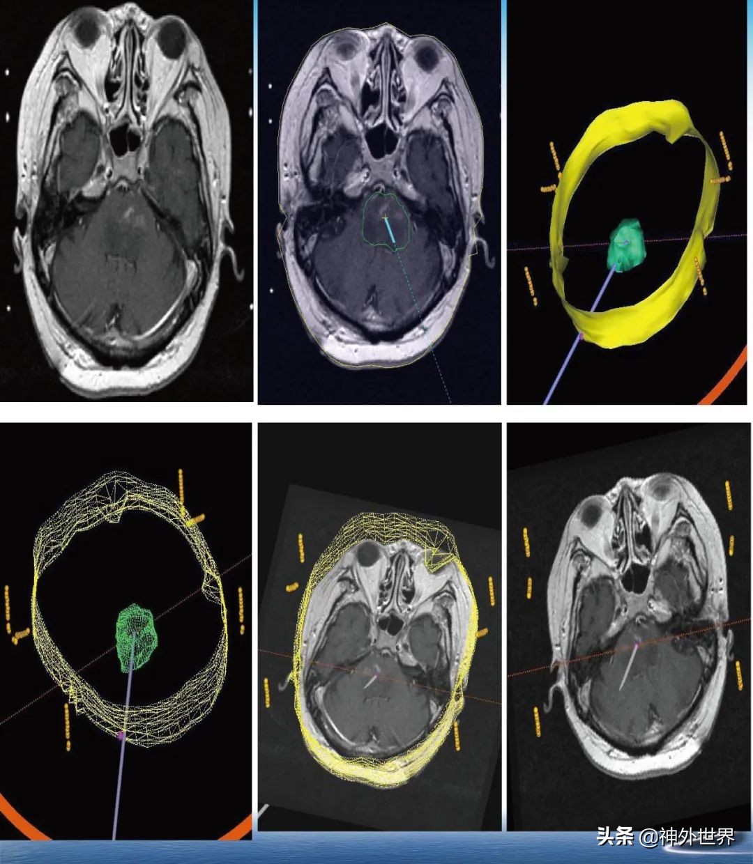 宣武医院神经外科王亚明祖籍,北京宣武医院神经科专家王亚明