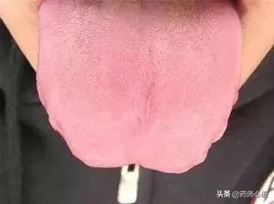 舌头健康表现,舌头出现信号对身体有什么危险