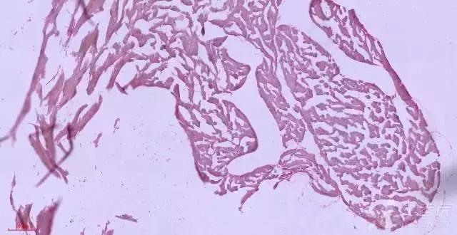 腿筋拉伤是不是腘绳肌拉伤,大腿内侧筋拉伤怎么处理