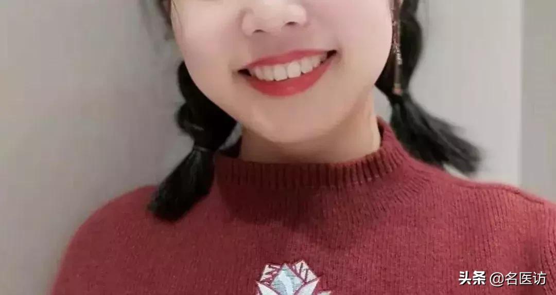 戴牙套2年不戴保持器反弹案例,戴牙套成功案例不戴保持器