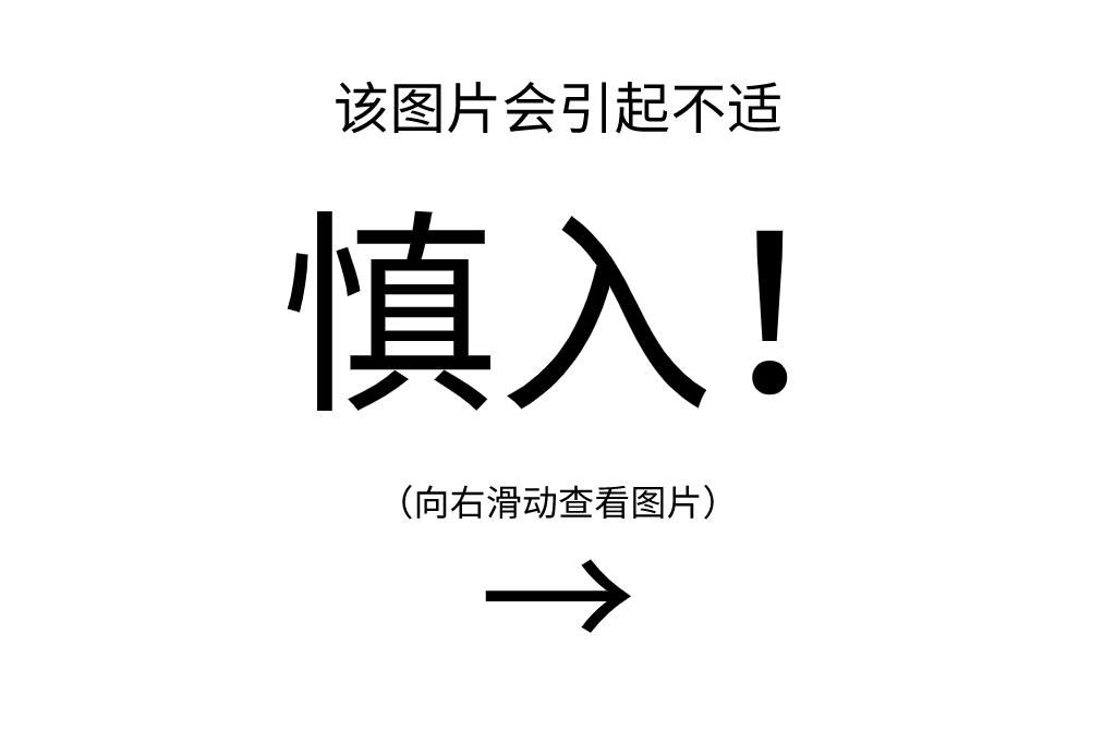 儿童小肠切除一部分以后会生长吗,儿童小肠切除后遗症