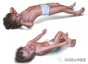 三个月的宝宝中医推拿退烧,中医推拿退烧最快方法