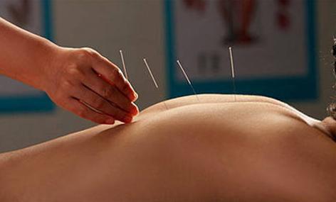 太原针灸科医生排名,太原中医针灸医院