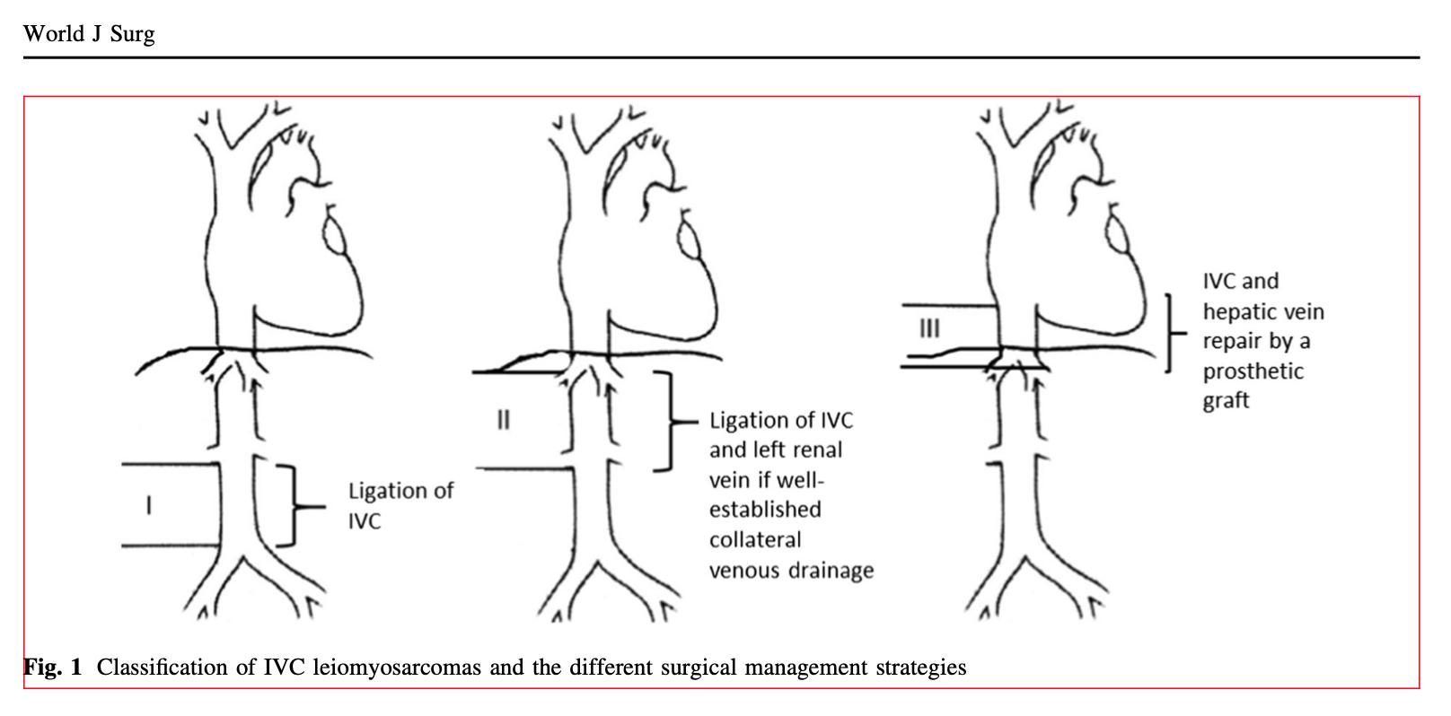 食管肿瘤侵犯血管要怎么治疗,纵隔肿瘤侵犯大血管还能手术吗