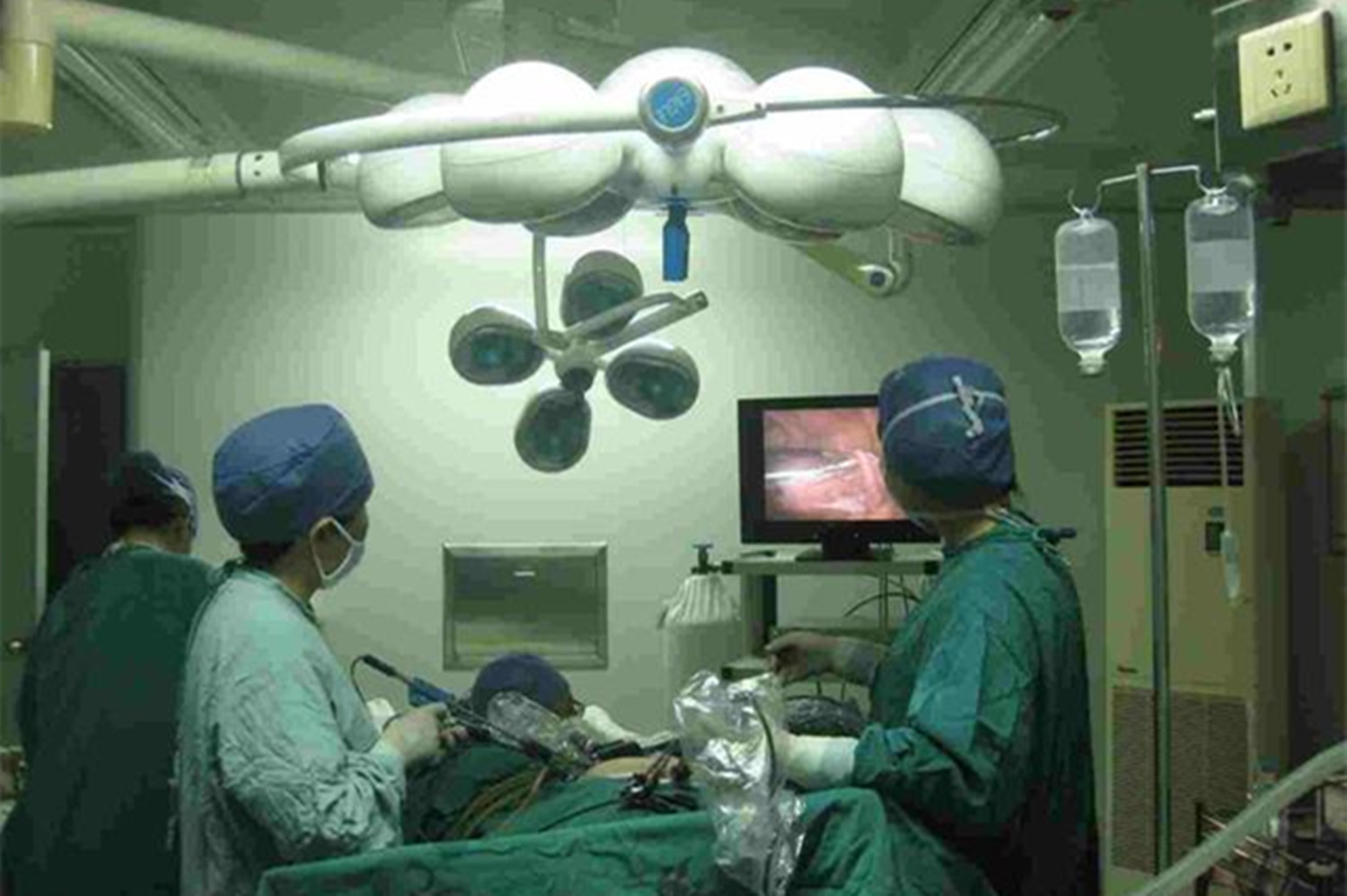 宝妈上节育环10年,宝妈节育环