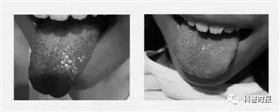 「科普时报」舌象：随身携带的“体检报告”