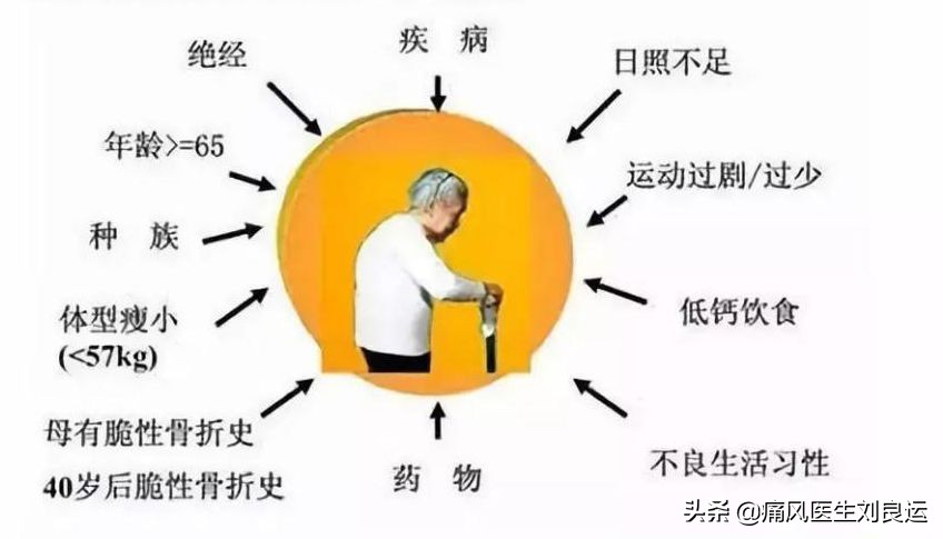 痛风血钙高,尿酸高引起的痛风骨头啥样的