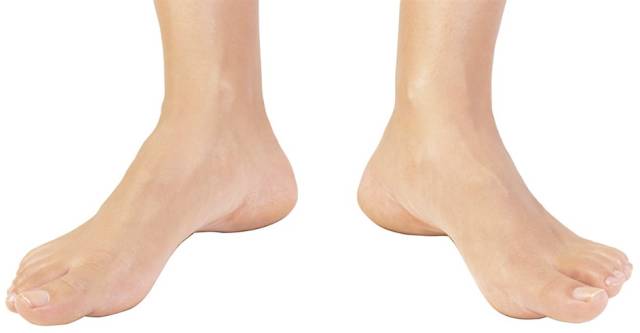 幼猫走路外八字怎么纠正,纠正内八字的训练方法