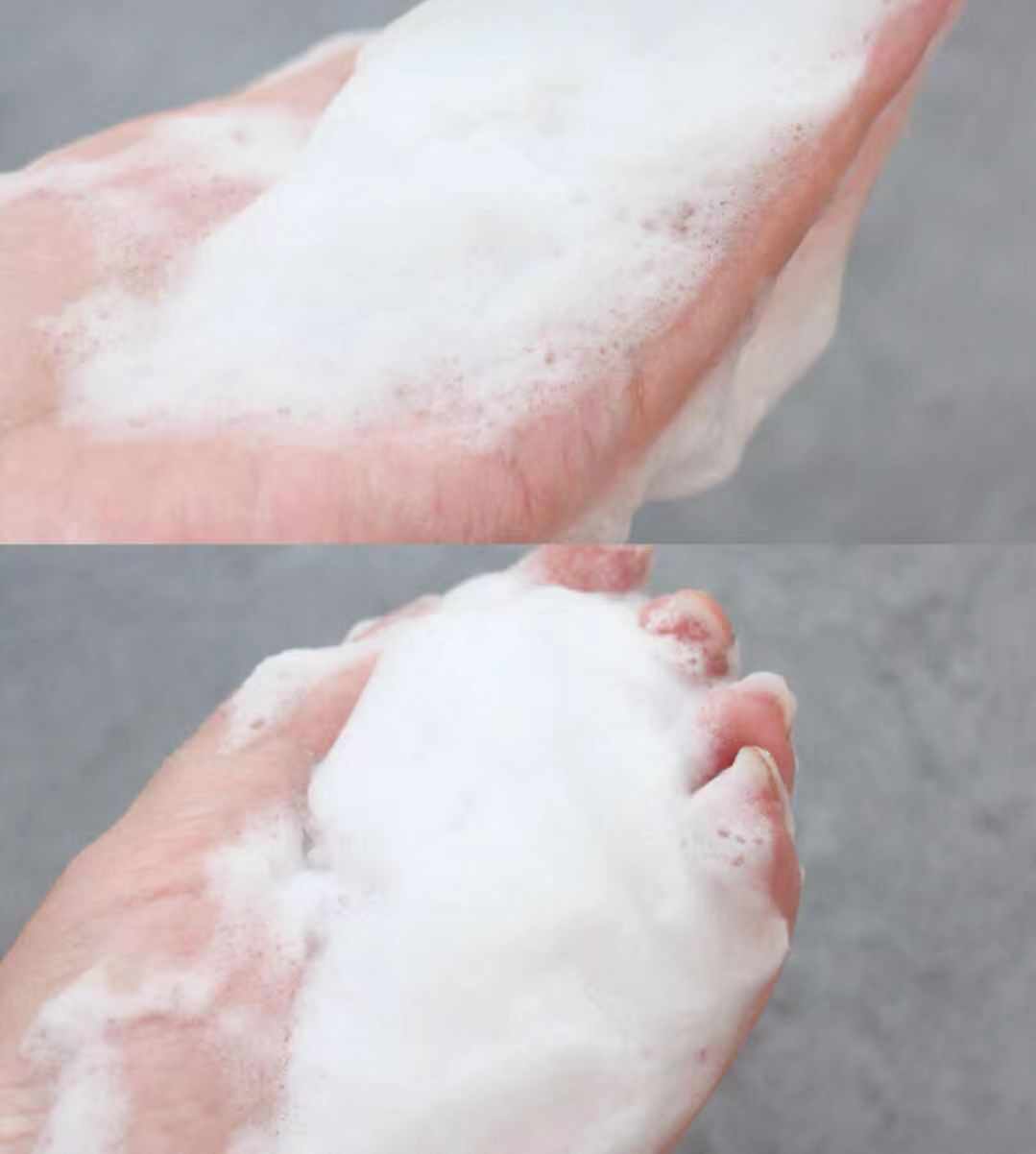 赵丽颖皮肤毛孔粗大图片,赵丽颖无美颜无滤镜最真实的模样