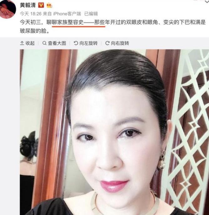 杭天琪白马,杭天琪白马纪录