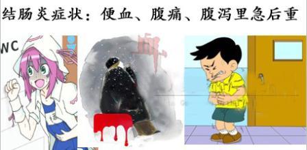 溃疡性结肠炎灌肠的药物有哪些,重度溃疡性结肠炎首选什么药物