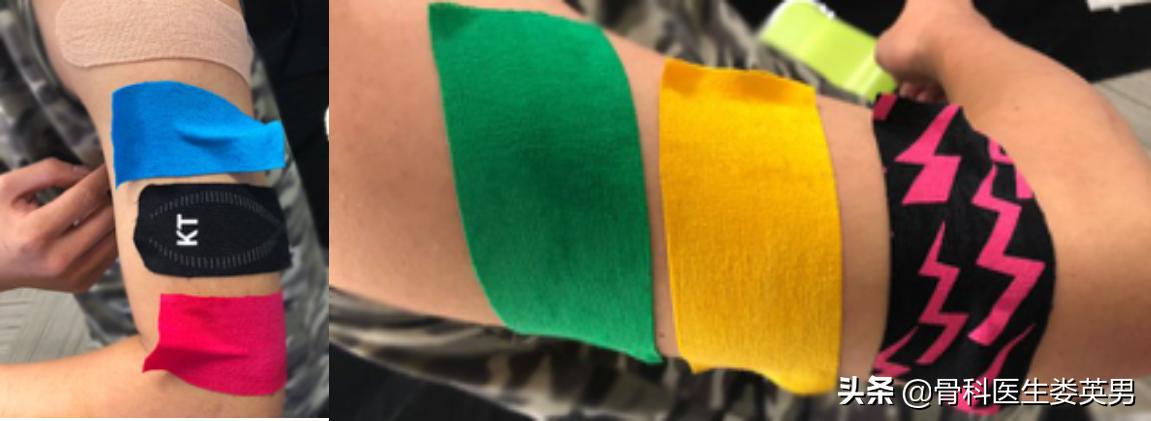 肌内贴测评,李宁国货引发争议