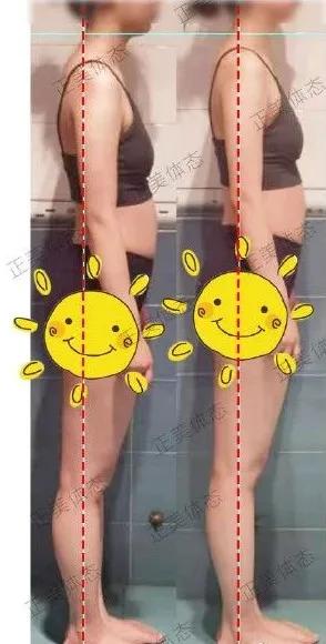 顽固性粗腿怎么瘦成筷子腿,腿型正常的小粗腿