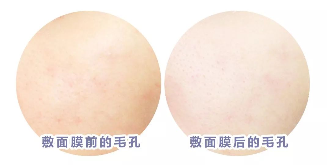 最近抖音很火的小气泡面膜有用吗,网红气泡面膜是真的吗