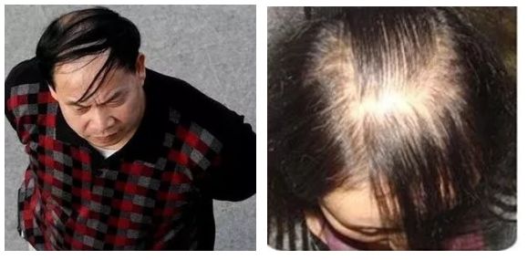 泰国生姜洗发水防脱发,泰国防脱发生姜洗发水