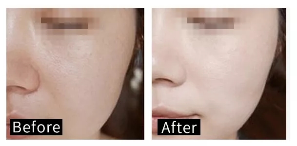 韩束面膜美白淡化色斑,韩束发光面膜