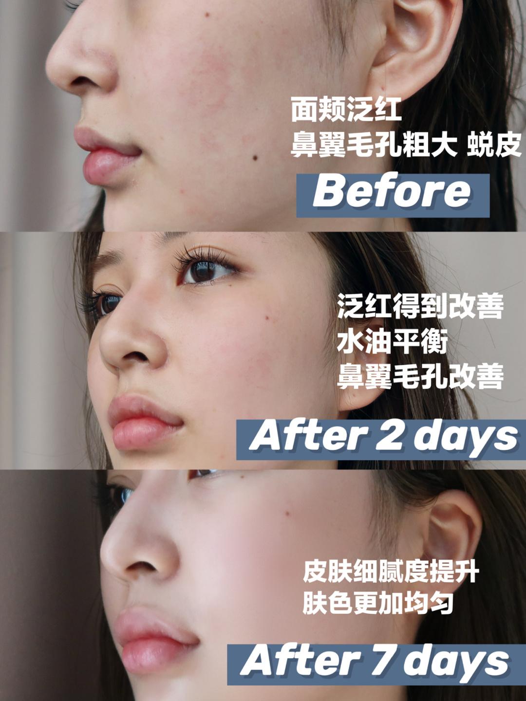 面霜大牌推荐排行榜第一名,娇兰面霜哪个系列最好