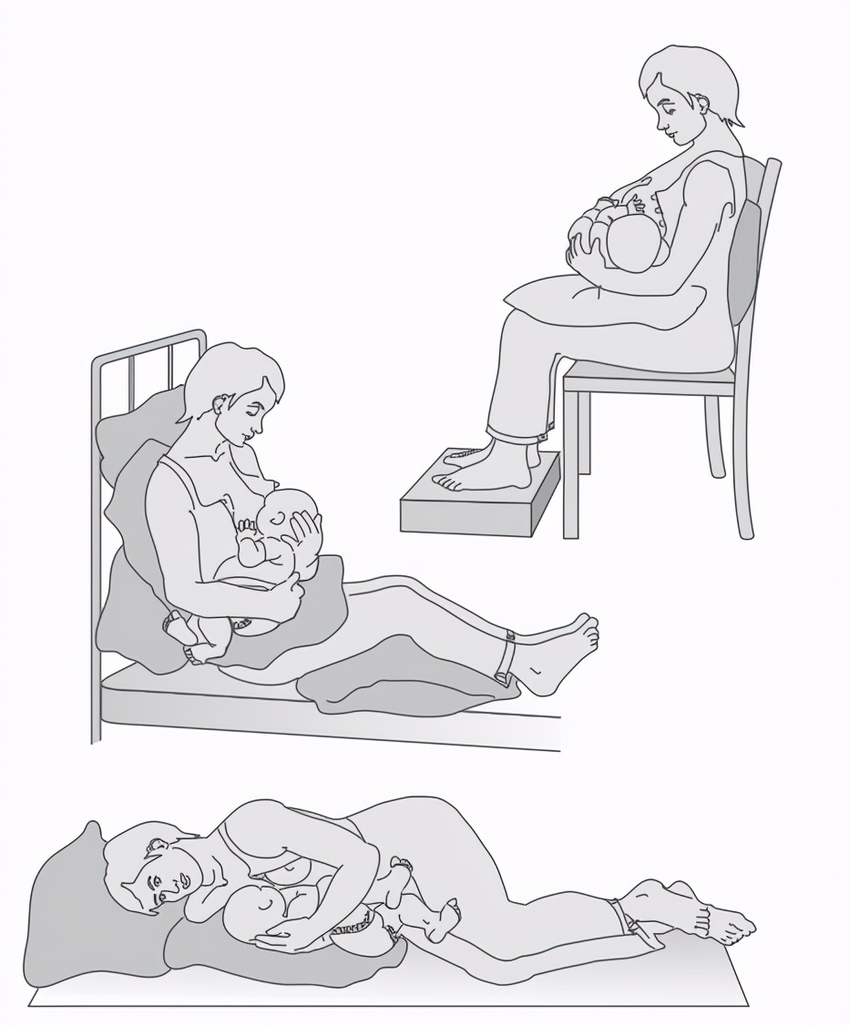 产后腰痛的原因及相关处理方法,产后腰痛是月子没有坐好吗