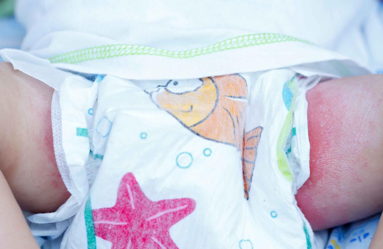 宝宝用湿巾擦屁股的正确方法,为什么用湿巾给宝宝擦屁股会红