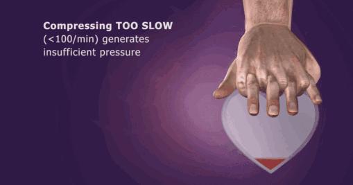 双人cpr心肺复苏术ppt,cpr心肺复苏标准操作流程