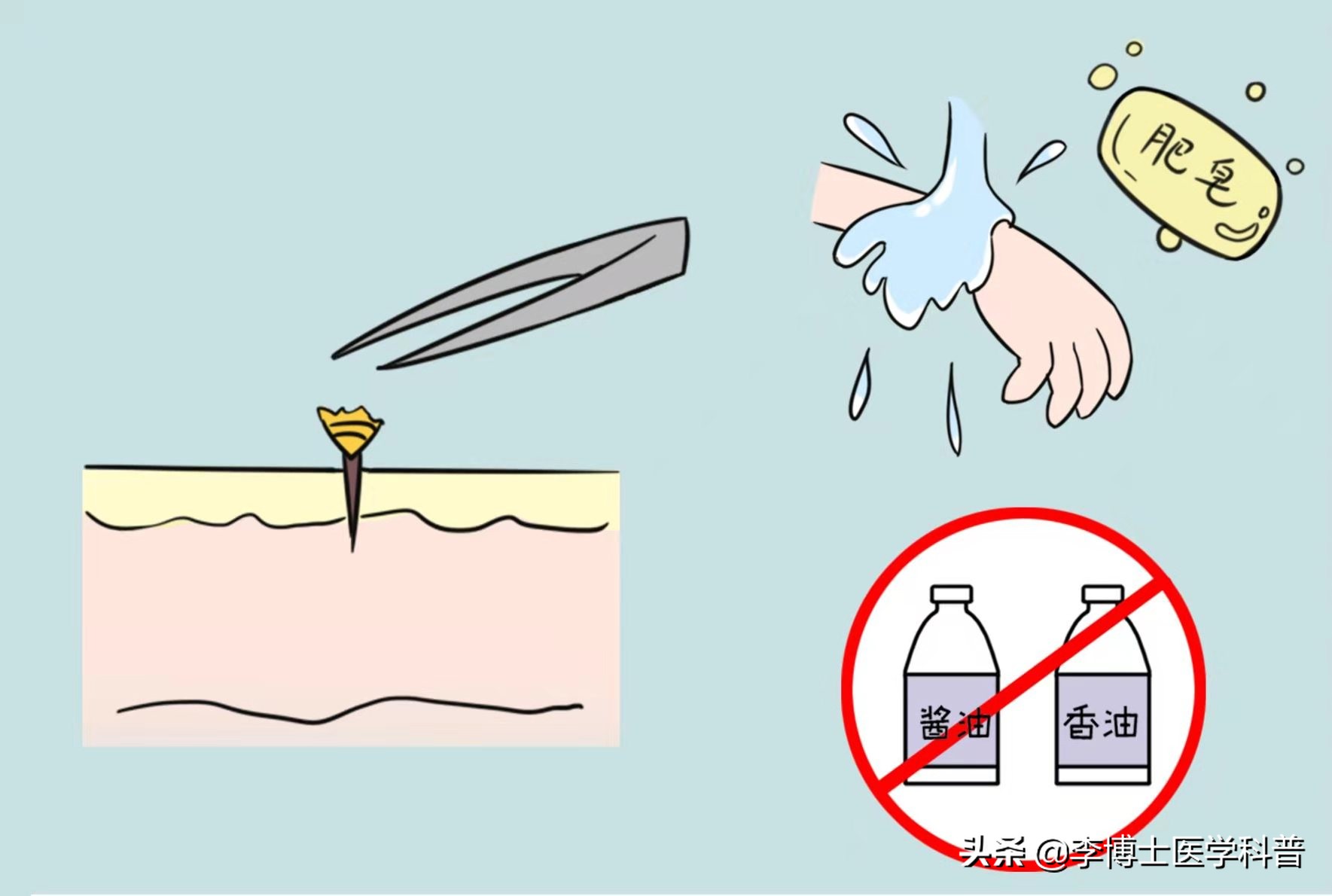 蜜蜂怎么防大黄蜂和小蜜蜂,养蜜蜂如何防范马蜂蜇伤