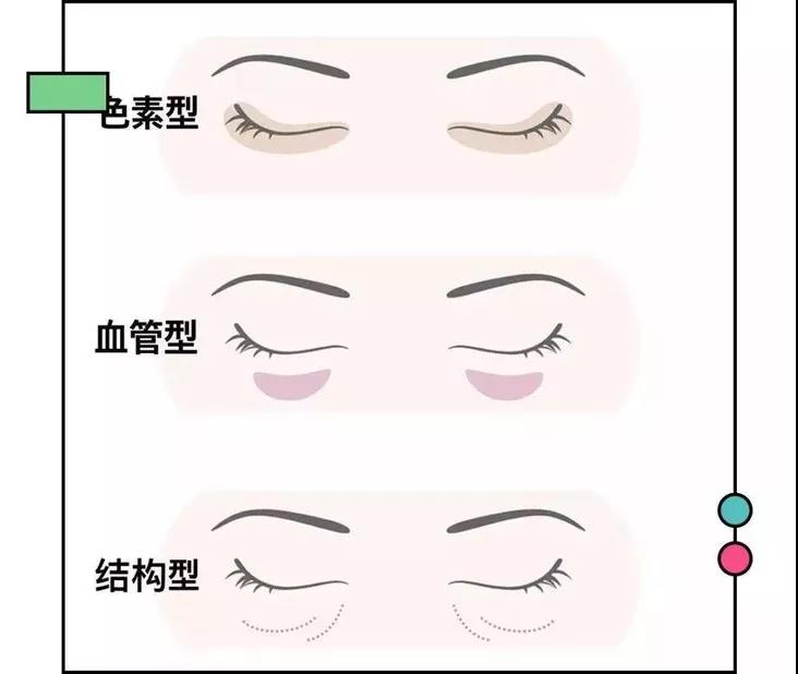 为什么眼睛大会显老？黑眼圈、眼袋、眼纹怎么去除？这两招就够了