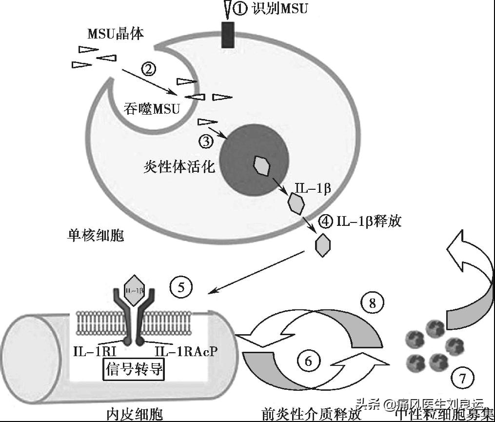 秋水仙碱可以缓解痛风吗,秋水仙碱对痛风有消肿止痛吗