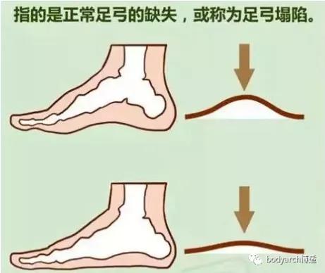 孕晚期脚后跟疼是怎么回事,孕期为什么脚后跟痛得厉害
