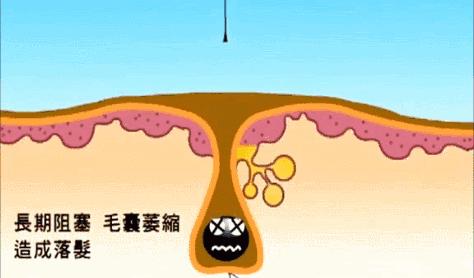 挑战3天不洗头依然干爽不油腻,4天不洗头头发就油了正常吗