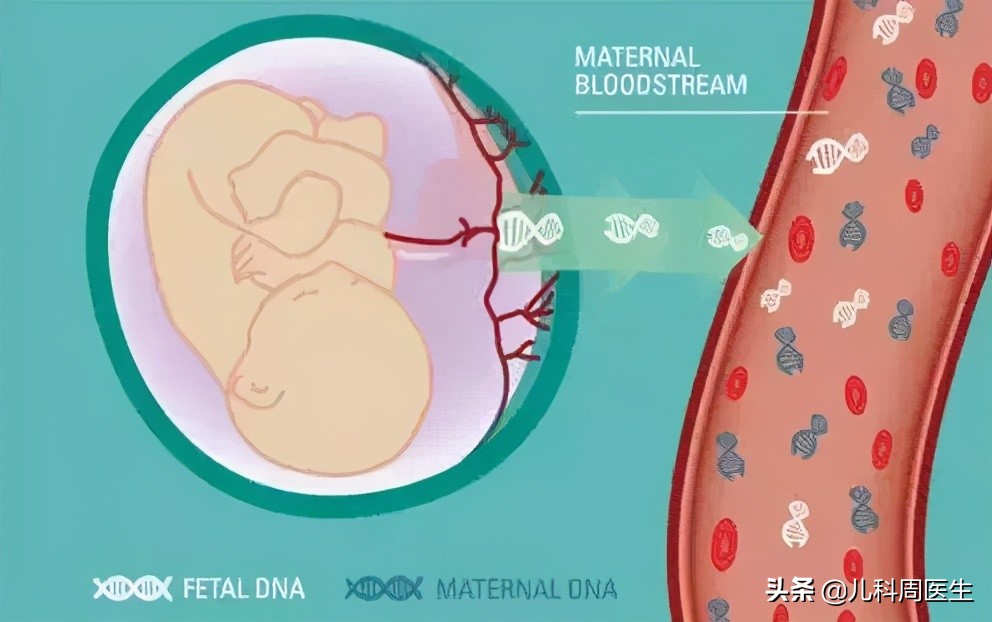 高龄唐筛21三体临界风险有没有事,唐筛21三体综合征会不会误诊