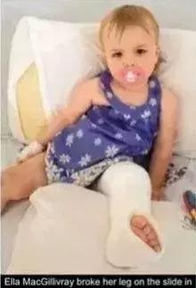 孩子在滑滑梯头朝下滑导致骨折,小孩玩滑梯骨折了怎么办