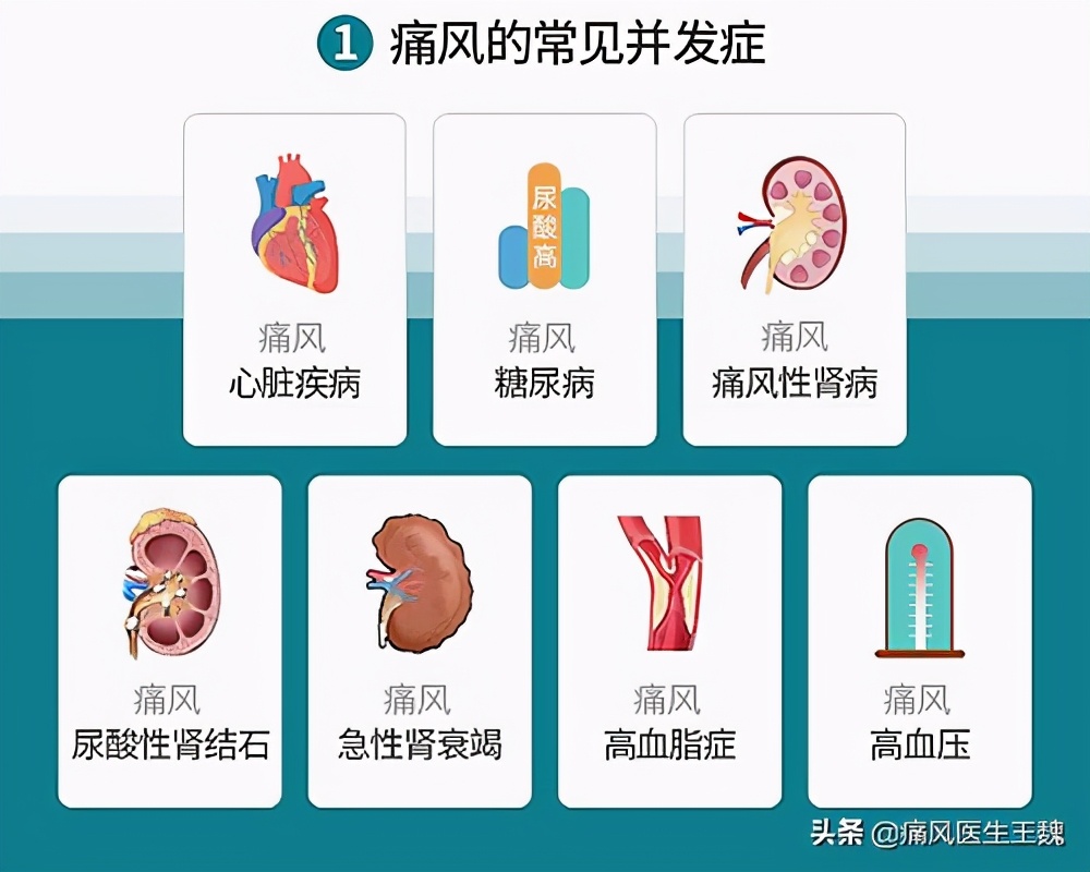 痛风患者饮食原则，你真的清楚了吗？