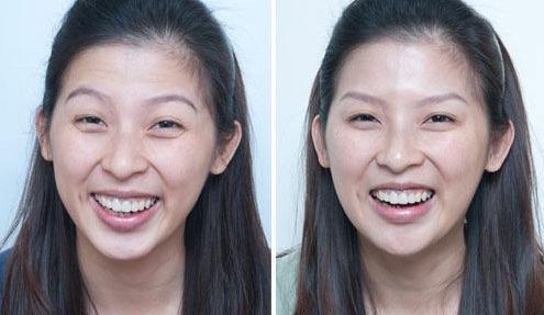 戚薇力荐的眼霜，用后黑眼圈细纹都没了，李佳琦：确实不错