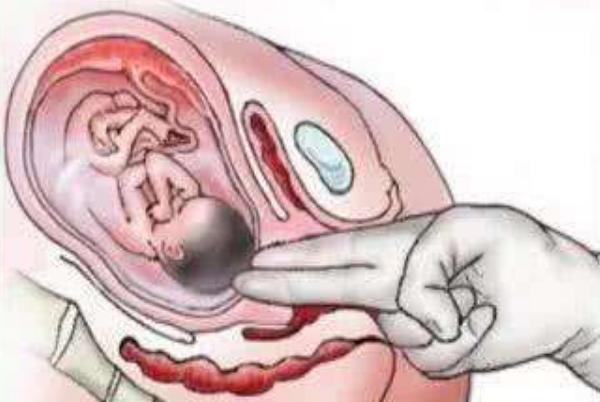 孕检中哪一项最尴尬？妈妈：男医生的“两指内检”