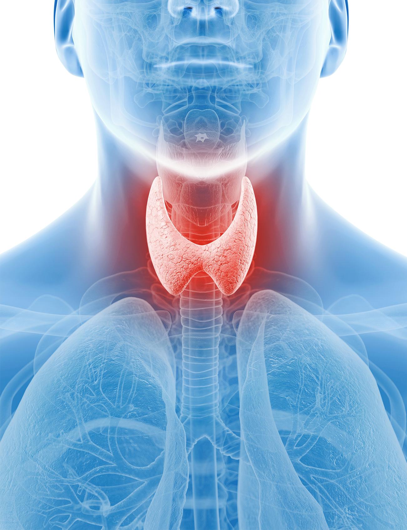 甲亢复发后的治疗方案,甲亢的治疗方案有哪几种