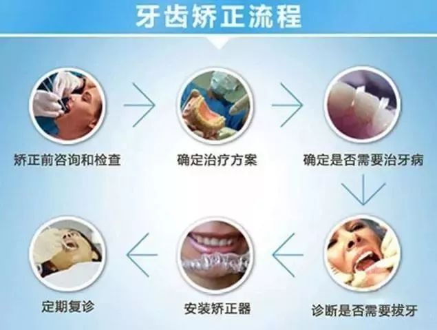 新款牙齿矫正价格,牙齿矫正性价比高品牌