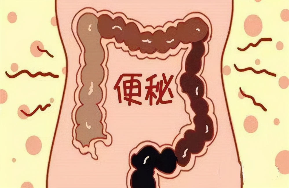 长期做提肛运动，有啥好处？上海男子做了大半年，说出真实感受