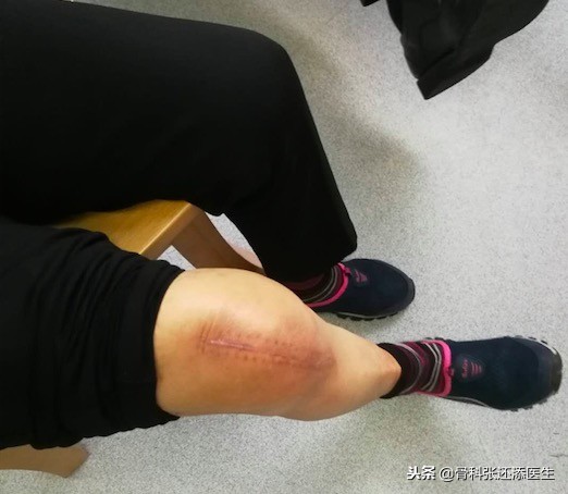 贴膝盖穴位贴药效有多长时间,膝关节疼贴药贴效果好