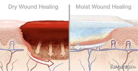 最好的医用面膜是哪种,公认最好用的医用面膜
