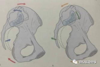 体态矫正之骨盆前倾