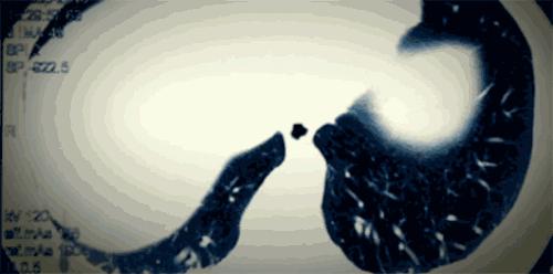 人死前会散发一种味道,人死之前会散发一种奇怪的味道吗