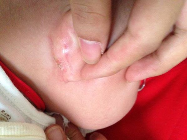 孩子的这些地方不能碰,孩子每天需要清洁哪些部位