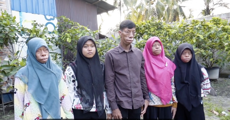 印尼兄妹酷似三星堆,印尼四兄妹怪异长相